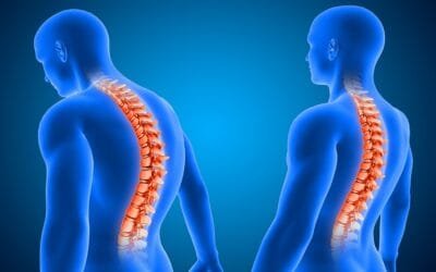 The Role of Posture in Maintaining a Healthy Spine