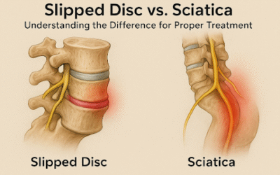 Slipped Disc vs. Sciatica: Understanding the Difference for Proper Treatment